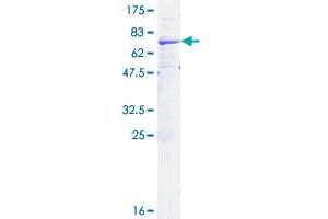 HSD11B2 Protein (AA 1-405) (GST tag)