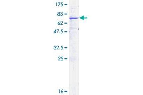 HSD11B2 Protein (AA 1-405) (GST tag)