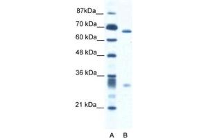 Western Blotting (WB) image for anti-Set1/Ash2 Histone Methyltransferase Complex Subunit ASH2 (ASH2L) antibody (ABIN2460893) (ASH2L 抗体)