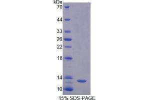 SDS-PAGE analysis of Pig Diamine Oxidase Protein. (DAO 蛋白)