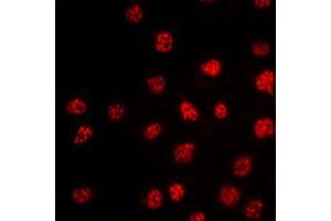 Immunofluorescent analysis of TBX15/18 staining in HepG2 cells. (T-Box 15/18 抗体  (Center))