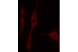 ABIN6274708 staining HepG2 cells by IF/ICC. (ORC1 抗体  (Internal Region))