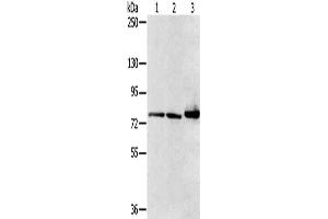 Gel: 6 % SDS-PAGE, Lysate: 40 μg, Lane 1-3: Mouse heart tissue, HT29 cells, mouse liver tissue, Primary antibody: ABIN7128752(CAPN7 Antibody) at dilution 1/300, Secondary antibody: Goat anti rabbit IgG at 1/8000 dilution, Exposure time: 1 second (Calpain 7 抗体)