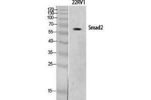 Western Blotting (WB) image for anti-SMAD, Mothers Against DPP Homolog 2 (SMAD2) (Ser801) antibody (ABIN6281530)