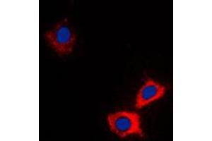 Immunofluorescence (IF) image for anti-ATP-Binding Cassette, Sub-Family B (MDR/TAP), Member 10 (ABCB10) (Center) antibody (ABIN7297968)