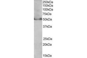 Image no. 1 for anti-Peroxisome Proliferator-Activated Receptor delta (PPARD) (C-Term), (Isoform 1) antibody (ABIN374465) (PPARD 抗体  (C-Term, Isoform 1))