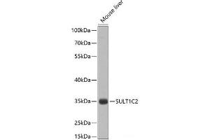 Western blot analysis of extracts of Mouse liver using SULT1C2 Polyclonal Antibody at dilution of 1:1000. (SULT1C2 抗体)