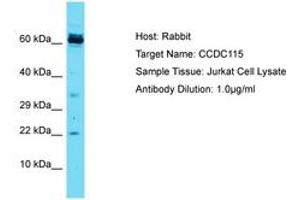 Image no. 1 for anti-Coiled-Coil Domain Containing 115 (CCDC115) (AA 47-96) antibody (ABIN6750443) (CCDC115 抗体  (AA 47-96))