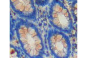 Used in DAB staining on fromalin fixed paraffin-embedded rectum tissue (CSN2 抗体  (AA 41-198))