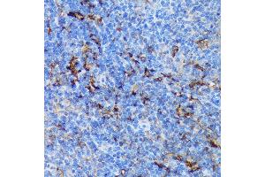 Immunohistochemistry (IHC) image for anti-Peptidyl Arginine Deiminase, Type IV (PADI4) (AA 374-550) antibody (ABIN7269207)