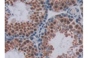 Detection of ENG in Mouse Testis Tissue using Polyclonal Antibody to Endoglin (ENG)