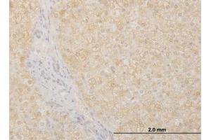 Immunoperoxidase of monoclonal antibody to POMGNT1 on formalin-fixed paraffin-embedded human liver. (POMGNT1 抗体  (AA 221-318))