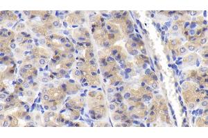 Immunohistochemistry (IHC) image for anti-Nucleoporin 85kDa (NUP85) (AA 130-368) antibody (ABIN7443029)