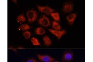 Immunofluorescence analysis of HeLa cells using HMGA1 Polyclonal Antibody at dilution of 1:100 (40x lens). (HMGA1 抗体)