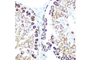 Immunohistochemistry of paraffin-embedded rat testis using STIP1 Rabbit pAb (ABIN6133089, ABIN6148592, ABIN6148593 and ABIN6218351) at dilution of 1:100 (40x lens). (STIP1 抗体  (AA 1-300))
