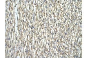 Rabbit Anti-HNRNPA2B1 antibody   Paraffin Embedded Tissue: Human Heart cell Cellular Data: cardiac cell of renal tubule Antibody Concentration: 4. (HNRNPA2B1 抗体  (N-Term))
