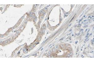 ABIN6272312 at 1/100 staining Human prostate tissue by IHC-P. (GRAP 抗体)