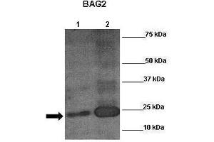 Sample Type: Lane 1:241 µg untransfected H1299 cells Lane 2: 041 µg siRUVBL2 transfected H1299 cells Primary Antibody Dilution: 1:0000Secondary Antibody: Anti-rabbit-HRP Secondary Antibody Dilution: 1:0000 Color/Signal Descriptions: RUVBL2  Gene Name: Wenwei Hu, Xuetian Yue, Rutgers Cancer Institute of New Jersey. (RUVBL2 抗体  (N-Term))