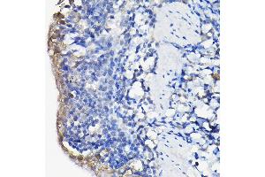 Immunohistochemistry of paraffin-embedded rat lung using Galectin 3/Galectin 3/LG Rabbit pAb (ABIN7267338) at dilution of 1:100 (40x lens). (Galectin 3 抗体  (AA 1-250))