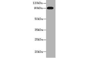 Western blot All lanes: NRG2 antibody at 16 μg/mL + U251 whole cell lysate Secondary Goat polyclonal to rabbit IgG at 1/10000 dilution Predicted band size: 92, 91, 93, 47, 46, 68, 71 kDa Observed band size: 92 kDa (Neuregulin 2 抗体  (AA 112-405))