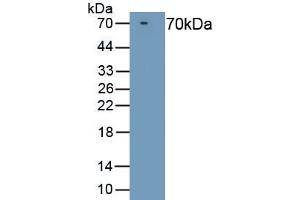 Detection of Recombinant F10, Rat using Polyclonal Antibody to Coagulation Factor X (F10) (Coagulation Factor X 抗体  (AA 21-482))