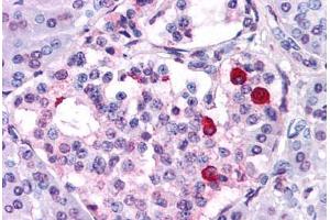 Anti-GIPR antibody  ABIN1048656 IHC staining of human pancreas. (GIPR 抗体  (N-Term))