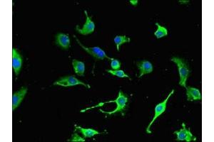 Immunofluorescent analysis of U251 cells using ABIN7161179 at dilution of 1:100 and Alexa Fluor 488-congugated AffiniPure Goat Anti-Rabbit IgG(H+L) (Nestin 抗体  (AA 1321-1569))