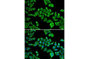 Immunofluorescence analysis of HeLa cell using DDX20 antibody. (DDX20 抗体)