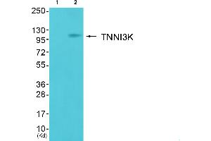 Western blot analysis of extracts from cos-7 cells (Lane 2), using TNNI3K Antibody.