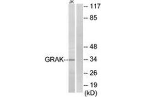 Western Blotting (WB) image for anti-Granzyme K (Granzyme 3, Tryptase II) (GZMK) (AA 61-110) antibody (ABIN2889995) (GZMK 抗体  (AA 61-110))