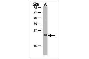 Western blot: Sample (30 µg of whole cell lysate). (ARL2 抗体  (AA 123-184))