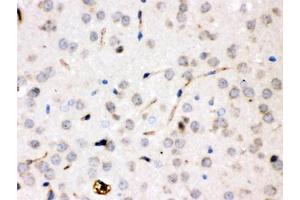 IHC testing of FFPE rat brain with CP antibody. (Ceruloplasmin 抗体  (AA 20-258))