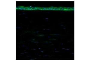 ALDH1A1 antibody used at a dilution of 1:200 to detect human cornea. (ALDH1A1 抗体  (Middle Region))