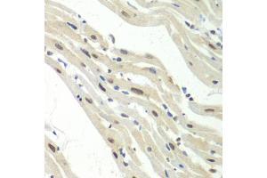 Immunohistochemistry of paraffin-embedded mouse heart using UPF1/RENT1 antibody  at dilution of 1:100 (40x lens). (RENT1/UPF1 抗体  (AA 270-370))