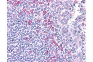 Immunohistochemistry (IHC) image for anti-delta-Like 1 (DLL1) (N-Term) antibody (ABIN2782684) (DLL1 抗体  (N-Term))