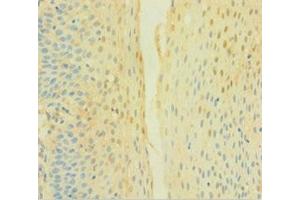 Immunohistochemistry of paraffin-embedded human tonsil tissue using ABIN7149094 at dilution of 1:100 (CYBB 抗体  (AA 283-570))
