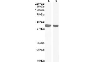 Western Blotting (WB) image for anti-Actin, alpha 2, Smooth Muscle, Aorta (ACTA2) (N-Term) antibody (ABIN185271)
