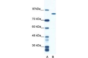 WB Suggested Anti-DHX16 Antibody Titration:  0. (DHX16 抗体  (N-Term))