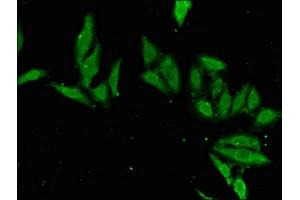 Immunofluorescent analysis of Hela cells using ABIN7155691 at dilution of 1:100 and Alexa Fluor 488-congugated AffiniPure Goat Anti-Rabbit IgG(H+L) (EN2 抗体  (AA 1-251))