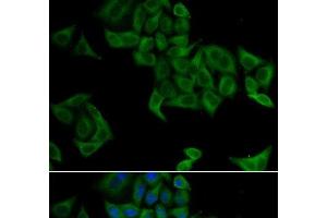 Immunofluorescence analysis of A549 cells using SMYD5 Polyclonal Antibody (SMYD5 抗体)