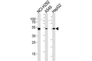 Western blot analysis of lysate from NCI-H292, A549, HepG2 cell line (left to right) using ALDH2 antibody at 1:1000 for each lane. (ALDH2 抗体)