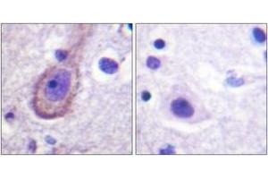 Immunohistochemistry (IHC) image for anti-Potassium Voltage-Gated Channel, KQT-Like Subfamily, Member 3 (KCNQ3) (AA 191-240), (pThr217) antibody (ABIN1531684)