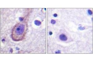 Immunohistochemistry analysis of paraffin-embedded human brain, using Kv7. (KCNQ3 抗体  (pThr217))