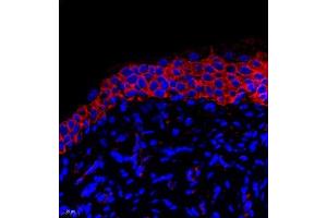 Immunofluorescent analysis of paraffin embedded rat bladder using PMCA1 (ABIN7073155) at dilution of 1: 500 (ATP2B1 抗体)