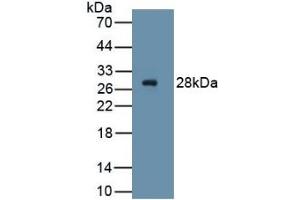 WB of Protein Standard: different control antibodies against Highly purified E. (PDGFRA ELISA 试剂盒)