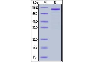 Human IL-12 R beta 1, Fc Tag on  under reducing (R) condition. (IL12RB1 Protein (AA 24-540) (Fc Tag))