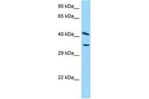 Image no. 1 for anti-ADP-Ribosylarginine Hydrolase (ADPRH) (C-Term) antibody (ABIN6748205) (ADPRH 抗体  (C-Term))