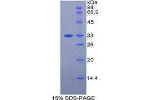 SDS-PAGE analysis of Mouse BST1 Protein. (BST1 蛋白)