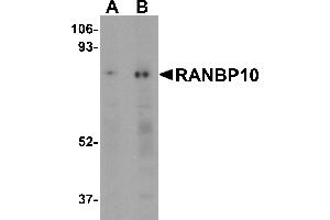 Western Blotting (WB) image for anti-RAN Binding Protein 10 (RANBP10) (Middle Region) antibody (ABIN1031052) (RANBP10 抗体  (Middle Region))
