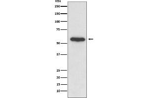 Western Blotting (WB) image for anti-Proto-oncogene tyrosine-protein kinase Src (Src) antibody (ABIN7606940)